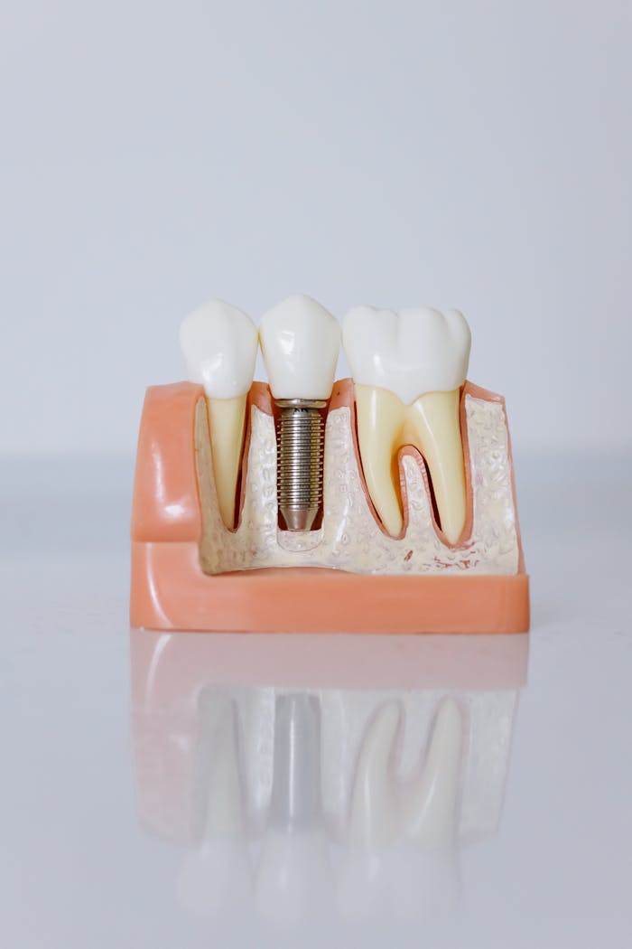 expertise-01 Detailed view of a dental implant model showcasing teeth and gum anatomy for dental education.